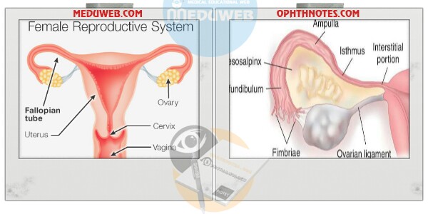 Image result for fallopian tube or oviduct