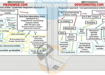 Clinical approach to Uveitis