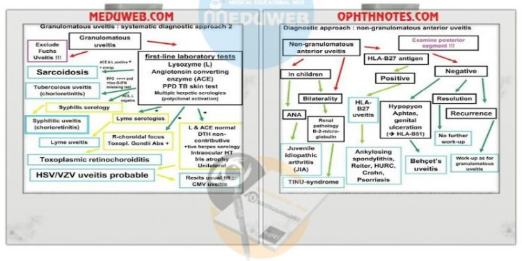 Clinical approach to Uveitis