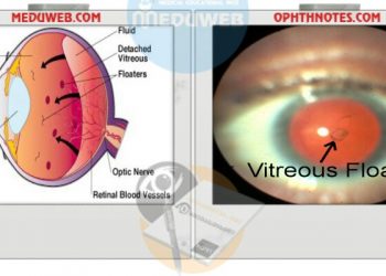 ✍️ DD of Flashes only