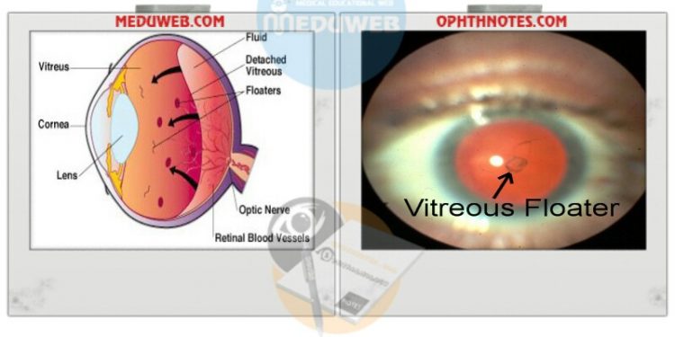 ✍️ DD of Flashes only