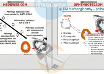The pathogenesis of diabetic microangiopathy.