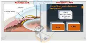 treat ocular HTN and glaucoma suspect