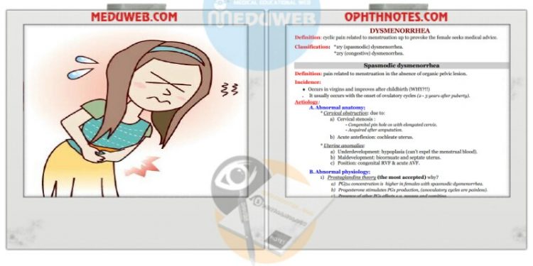 Dysmenorrhea