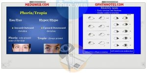 Tropias and Phorias