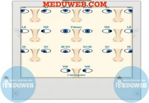 Clinical hints for your approach for examining ocular motility