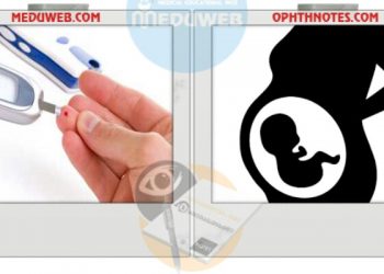 Management of Pregestational DM