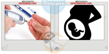 Management of Pregestational DM
