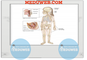 Facts of Rhabdomyosarcoma