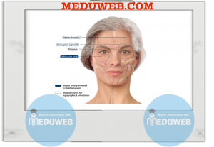 Blepharospasm