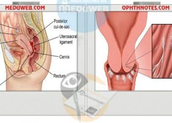 Disturbance of sexual relations