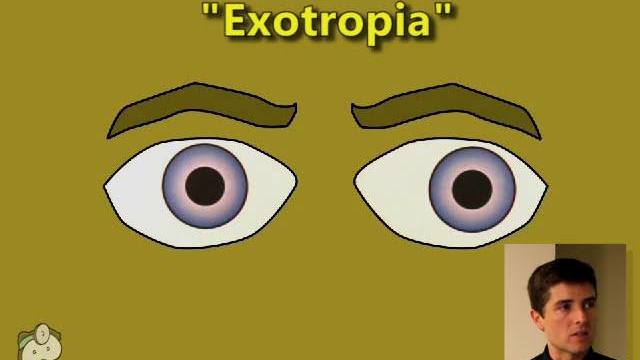 Eye Examination - Tropias & Phorias (part 1/2) by Tim Root video