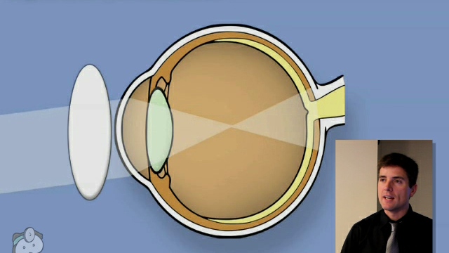 Retinoscopy (Part 2/2) by Tim Root video