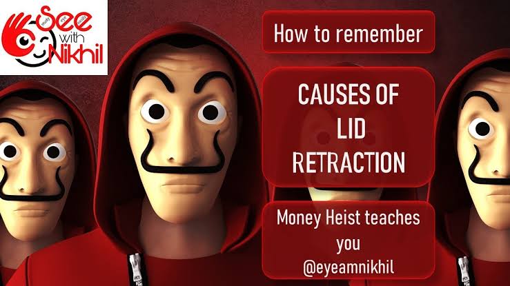 Causes of lid retraction : Money heist teaches you how to remember video